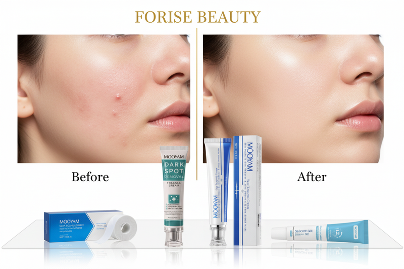 Scar & Acne Care Collection Banner