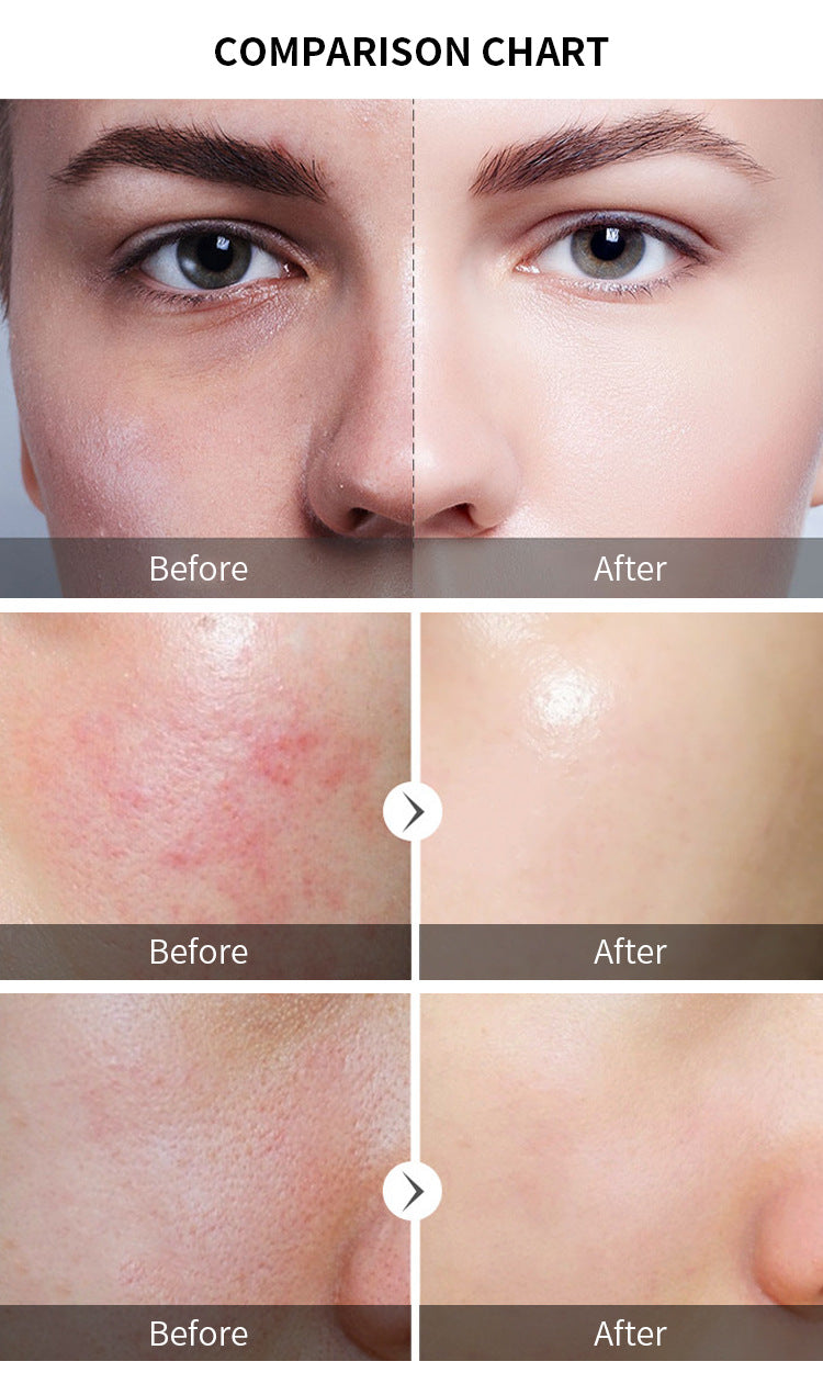 AHA Essence Exfoliating Serum Glycolic Acid Brightening Treatment For Dull Complexion Treatment