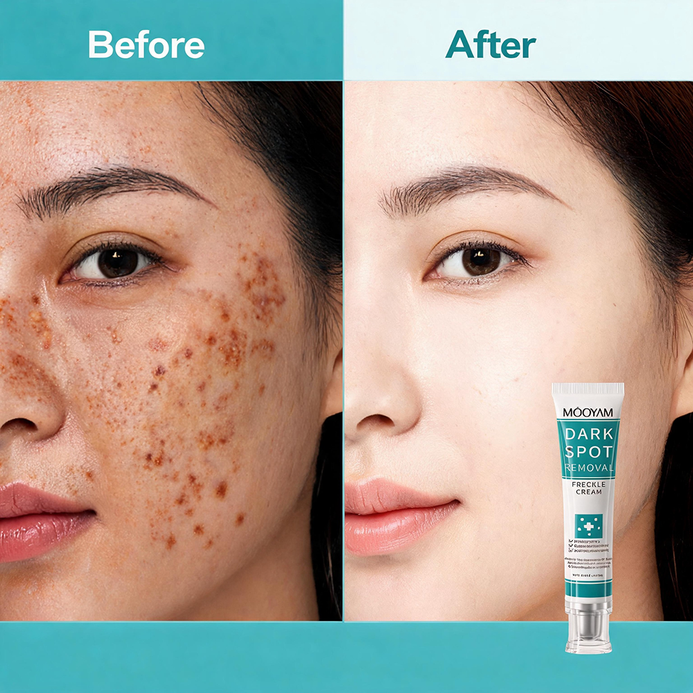 Premium Scar Diminishing Serum Advanced Cell Regeneration for Discolored Scars