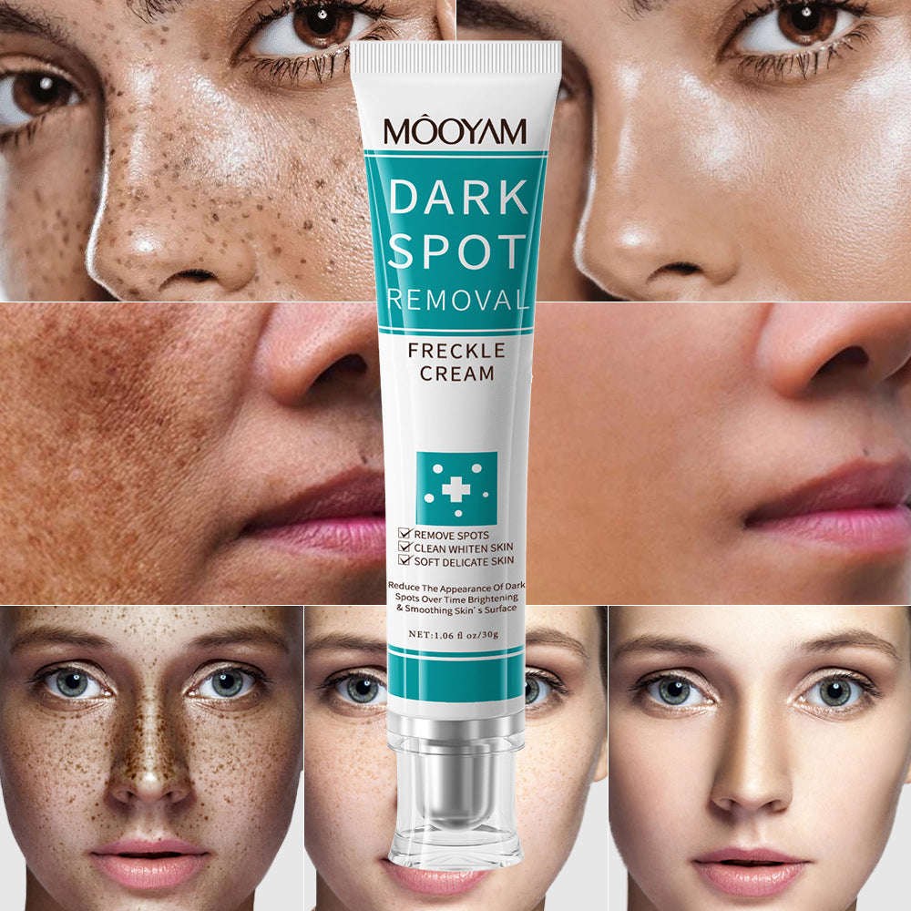 MOOYAM Dark Spot Removal Freckle Cream - Reduces dark spots, fades freckles and evens skin tone for a clearer, brighter complexion