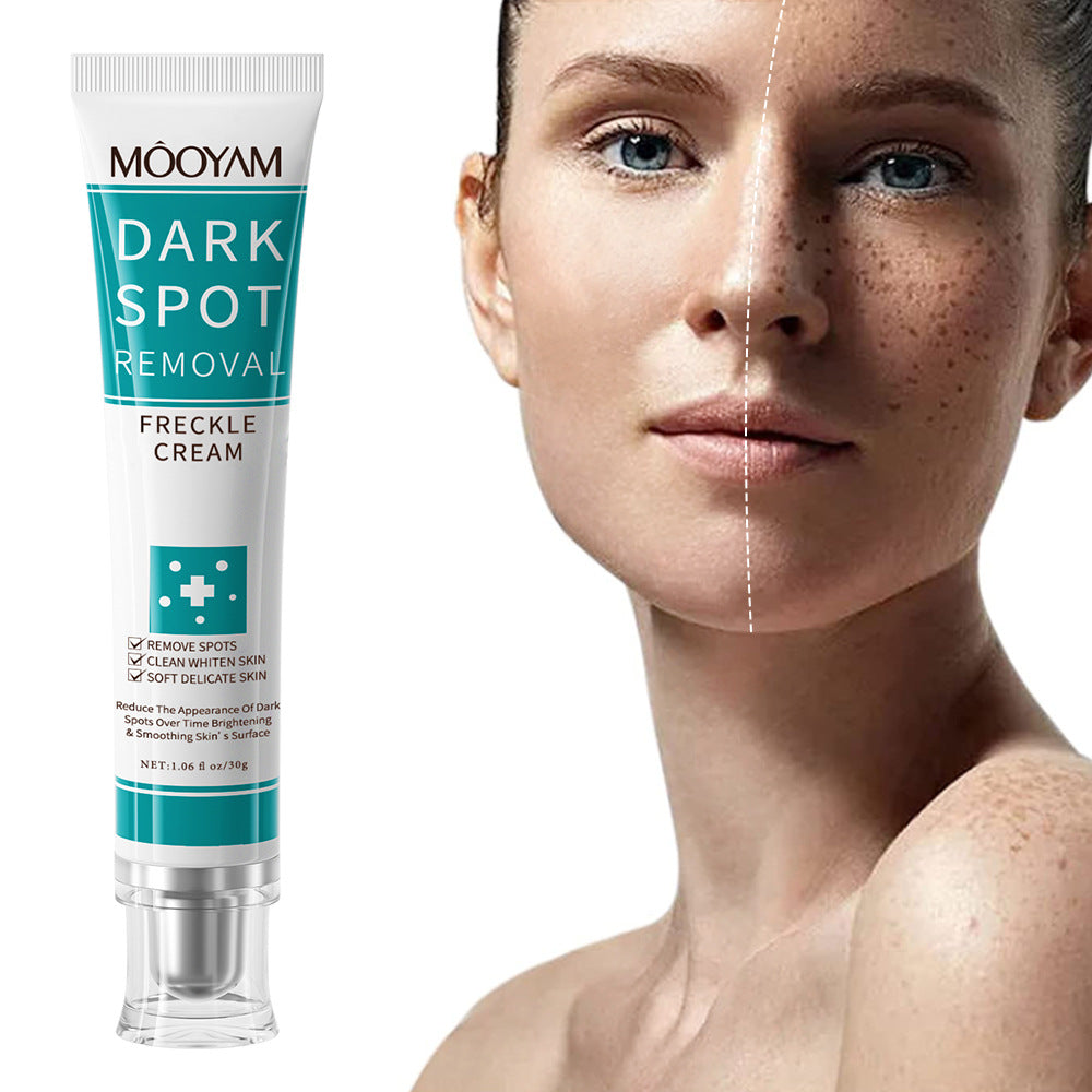 MOOYAM Dark Spot Removal Freckle Cream - Reduces dark spots, fades freckles and evens skin tone for a clearer, brighter complexion