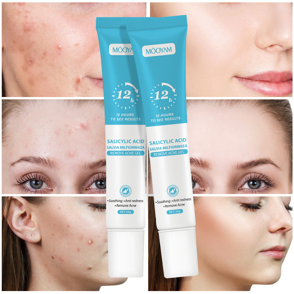 MOOYAM Salicylic Acid & Salvia Miltiorrhiza Remove Acne Gel 20g – soothes redness, removes acne, results in 12 hours, tube and box packaging