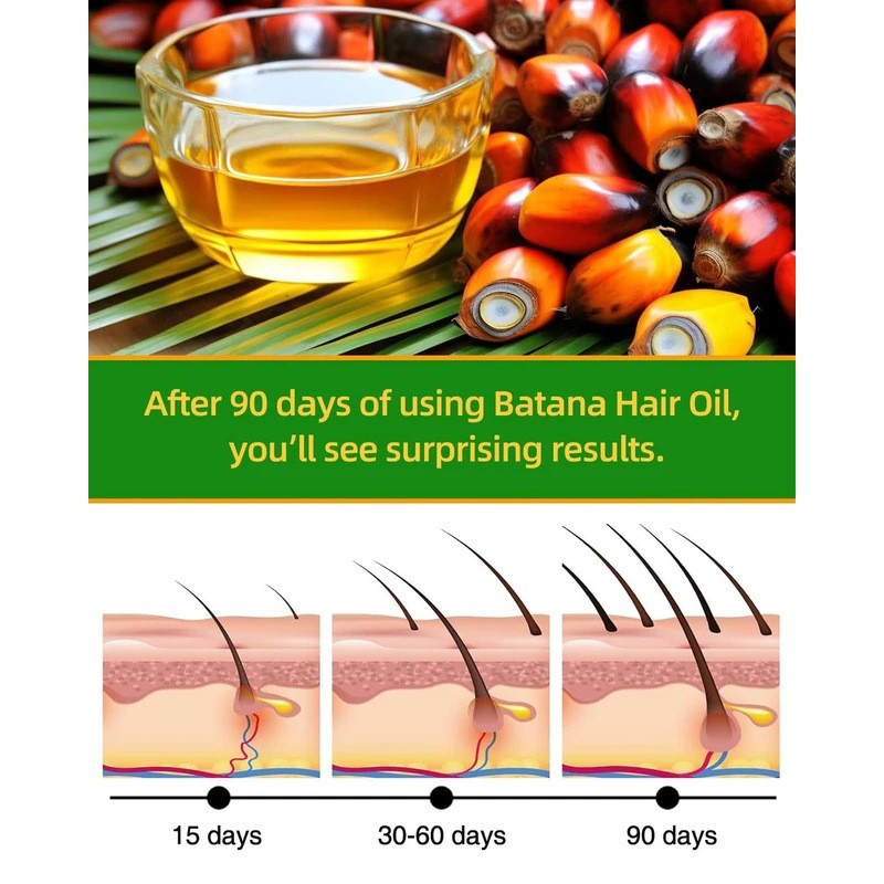 CARVENCHY 100% Pure Batana Oil with Rosemary Oil, Hair Growth Serum & Scalp Detox, 30ml dropper bottle with packaging