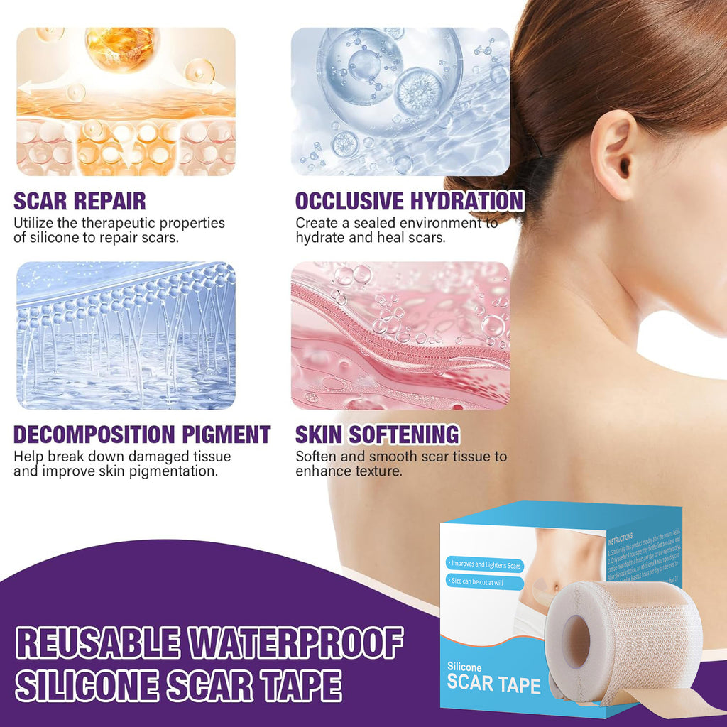 Silicone Scar Tape Sheets Roll - Improves and lightens scars, suitable for keloid and hypertrophic scars, size can be cut to fit