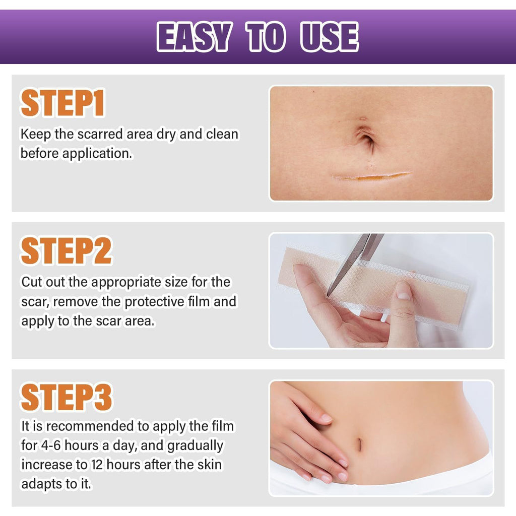 Silicone Scar Tape Sheets Roll - Improves and lightens scars, suitable for keloid and hypertrophic scars, size can be cut to fit