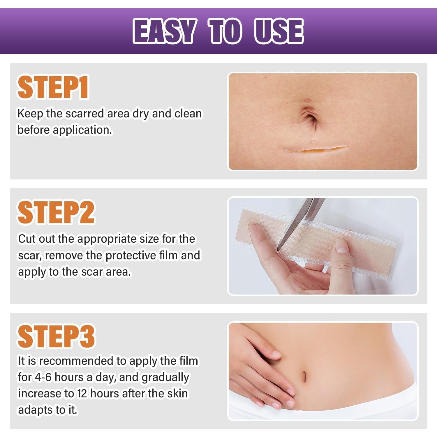 Silicone Scar Tape Sheets Roll - Improves and lightens scars, suitable for keloid and hypertrophic scars, size can be cut to fit
