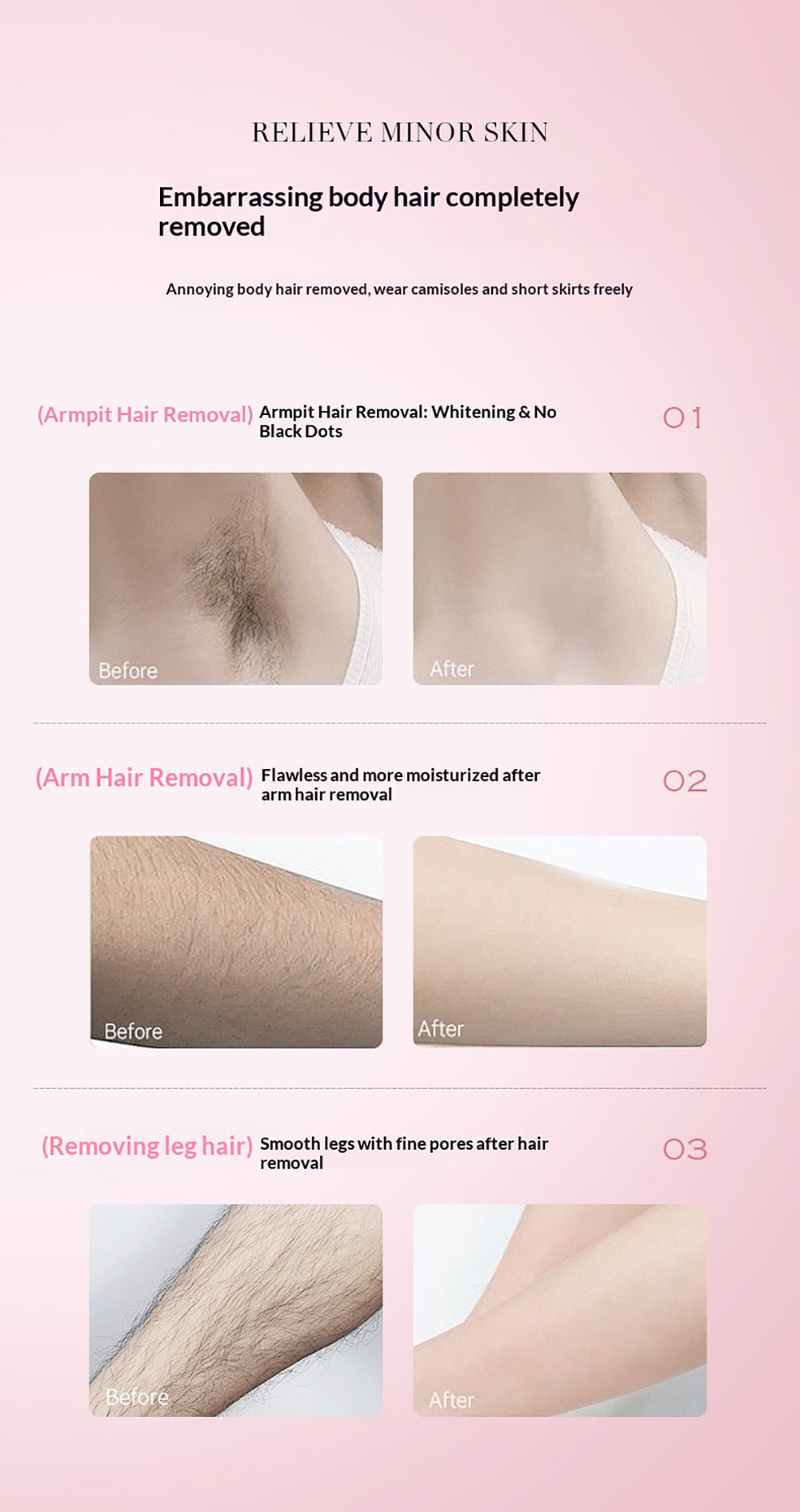 FORISE Beauty Soothing Hair Removal Cream 60g - Gentle depilatory cream in pink tube for smooth, hair-free skin