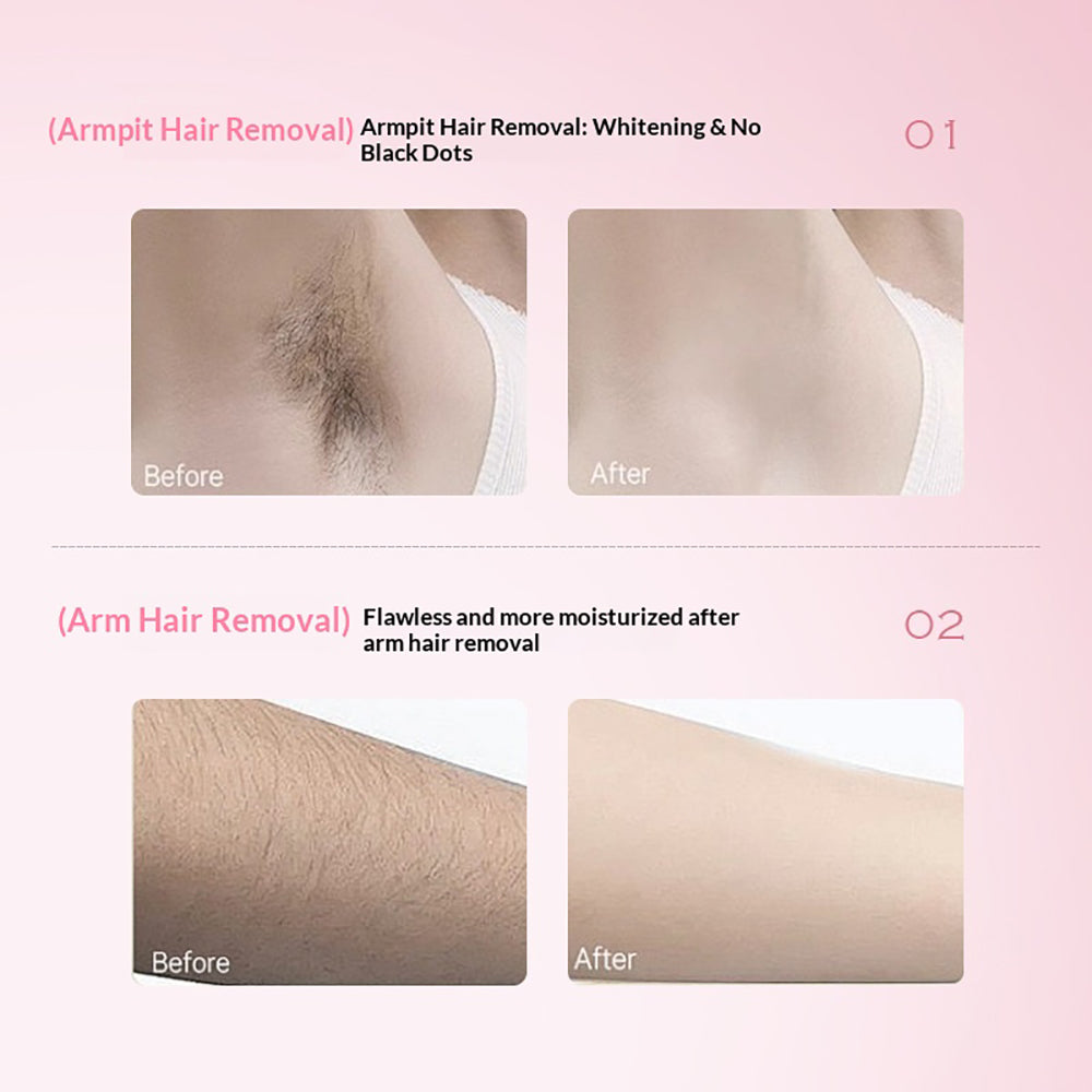 FORISE Beauty Soothing Hair Removal Cream 60g - Gentle depilatory cream in pink tube for smooth, hair-free skin