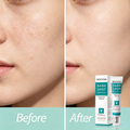 MOOYAM Dark Spot Removal Freckle Cream - Reduces dark spots, fades freckles and evens skin tone for a clearer, brighter complexion