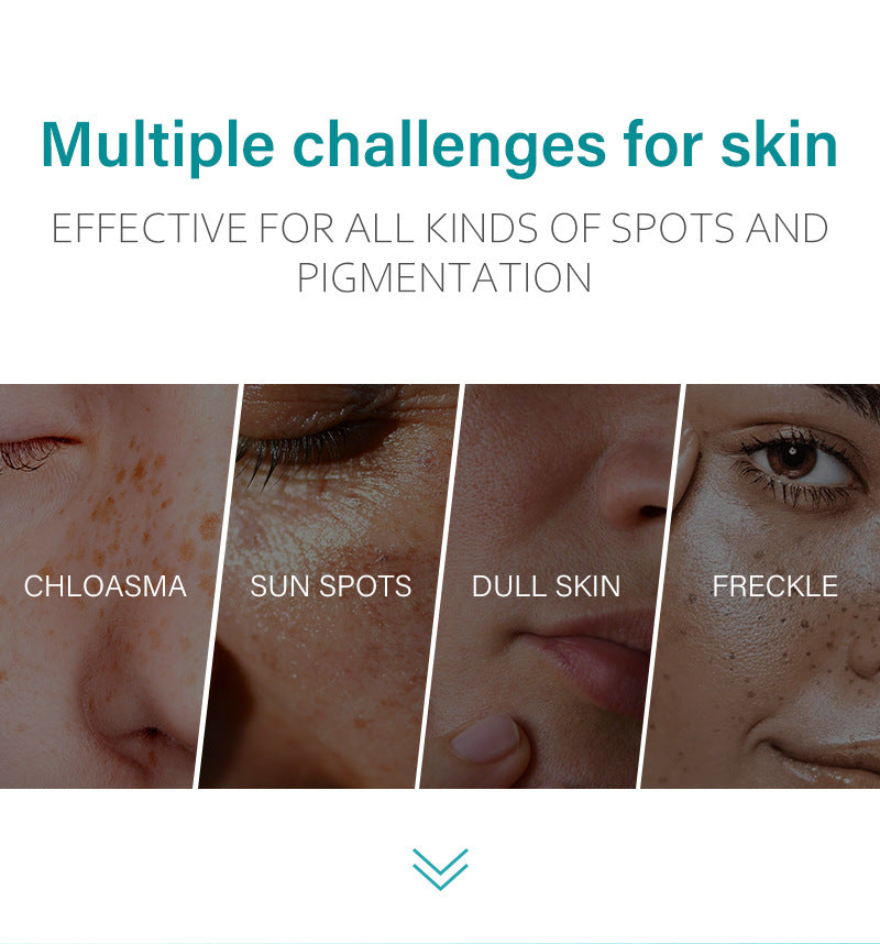 MOOYAM Dark Spot Removal Freckle Cream - Reduces dark spots, fades freckles and evens skin tone for a clearer, brighter complexion