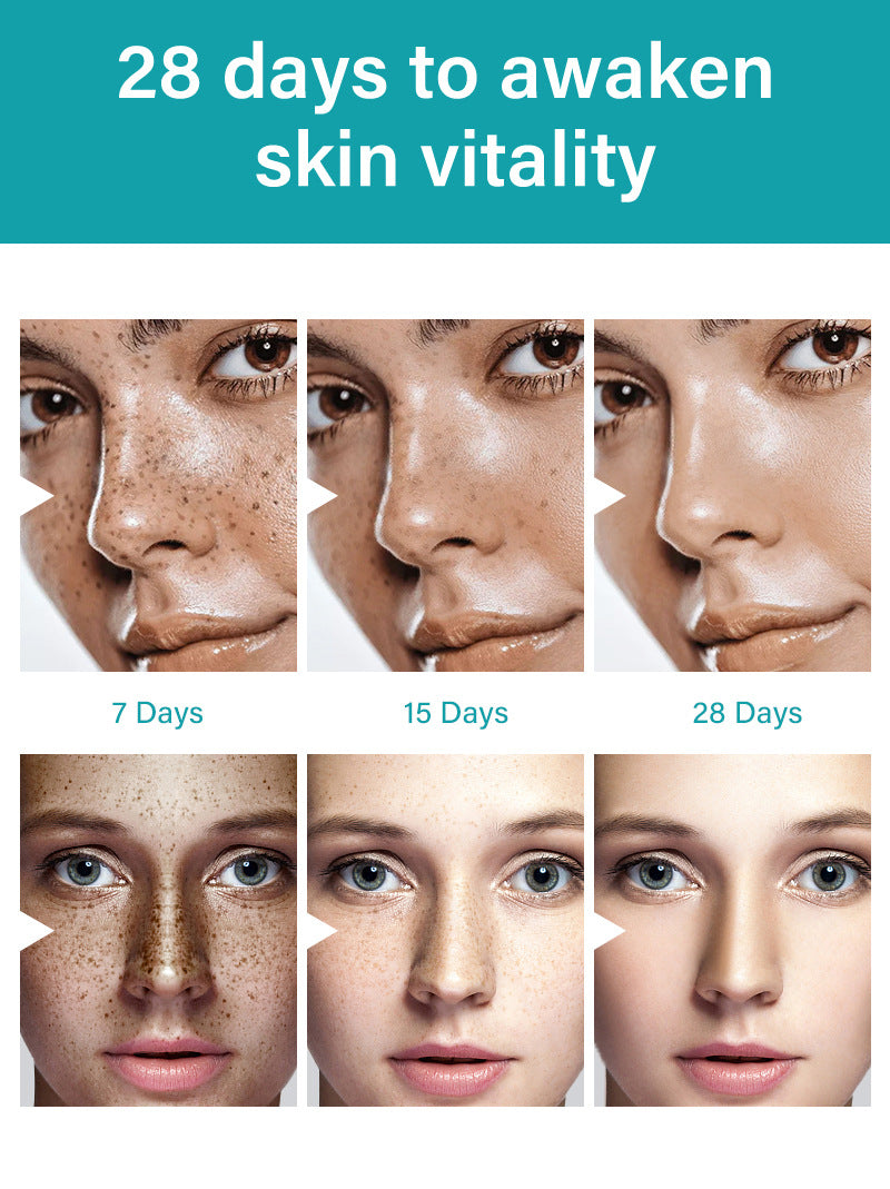 MOOYAM Dark Spot Removal Freckle Cream - Reduces dark spots, fades freckles and evens skin tone for a clearer, brighter complexion