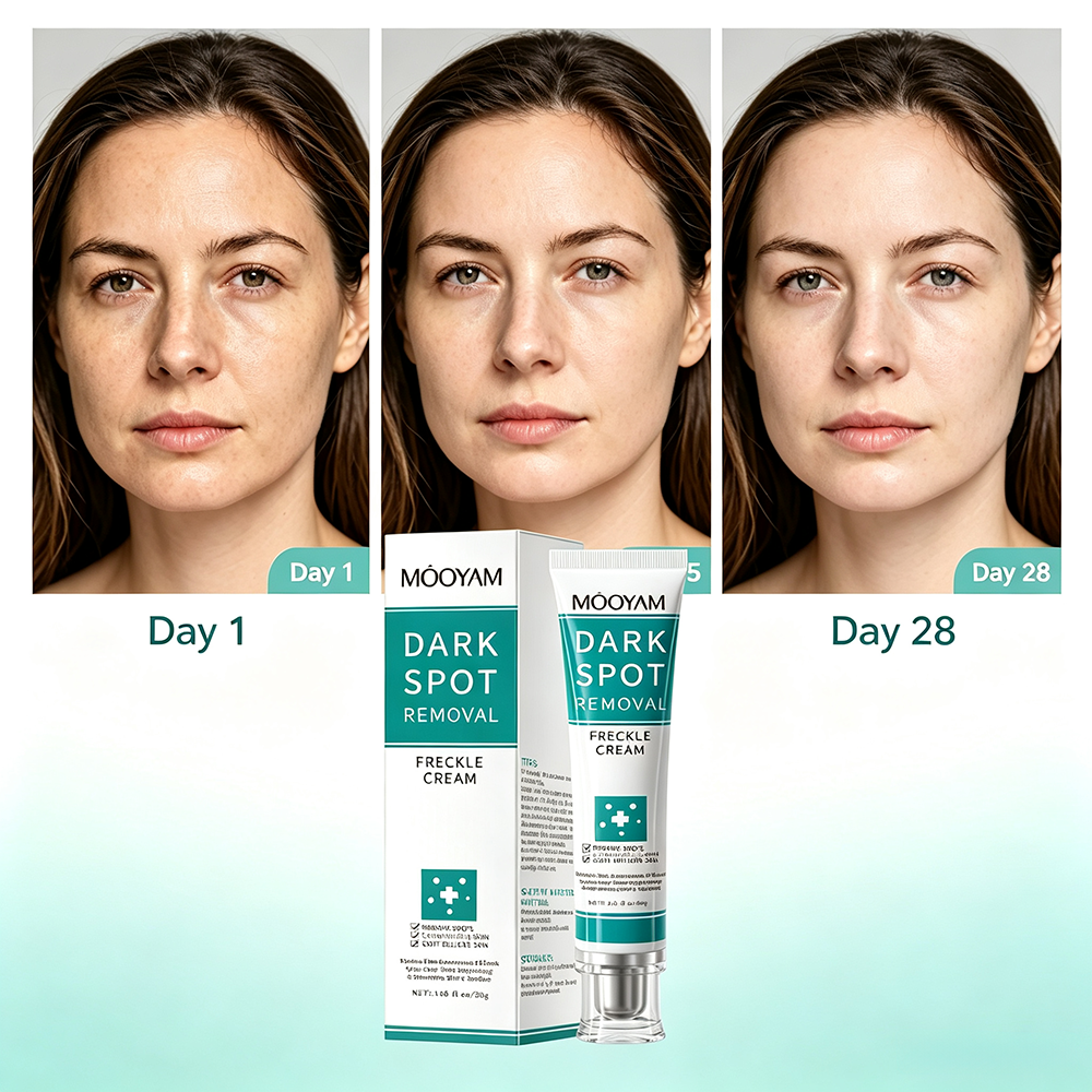 MOOYAM Dark Spot Removal Freckle Cream - Reduces dark spots, fades freckles and evens skin tone for a clearer, brighter complexion