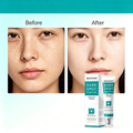 MOOYAM Dark Spot Removal Freckle Cream - Reduces dark spots, fades freckles and evens skin tone for a clearer, brighter complexion