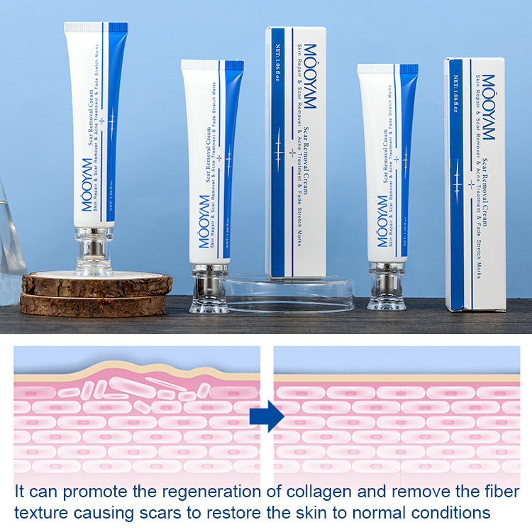 MOOYAM Scar Removal Cream tube and box, Skin Repair & Scar Remover & Acne Treatment & Fade Stretch Marks, 1.06 fl oz