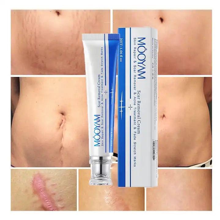 MOOYAM Scar Removal Cream tube and box, Skin Repair & Scar Remover & Acne Treatment & Fade Stretch Marks, 1.06 fl oz