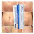 MOOYAM Scar Removal Cream tube and box, Skin Repair & Scar Remover & Acne Treatment & Fade Stretch Marks, 1.06 fl oz