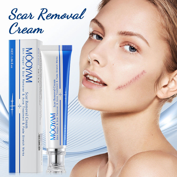 MOOYAM Scar Removal Cream tube and box, Skin Repair & Scar Remover & Acne Treatment & Fade Stretch Marks, 1.06 fl oz