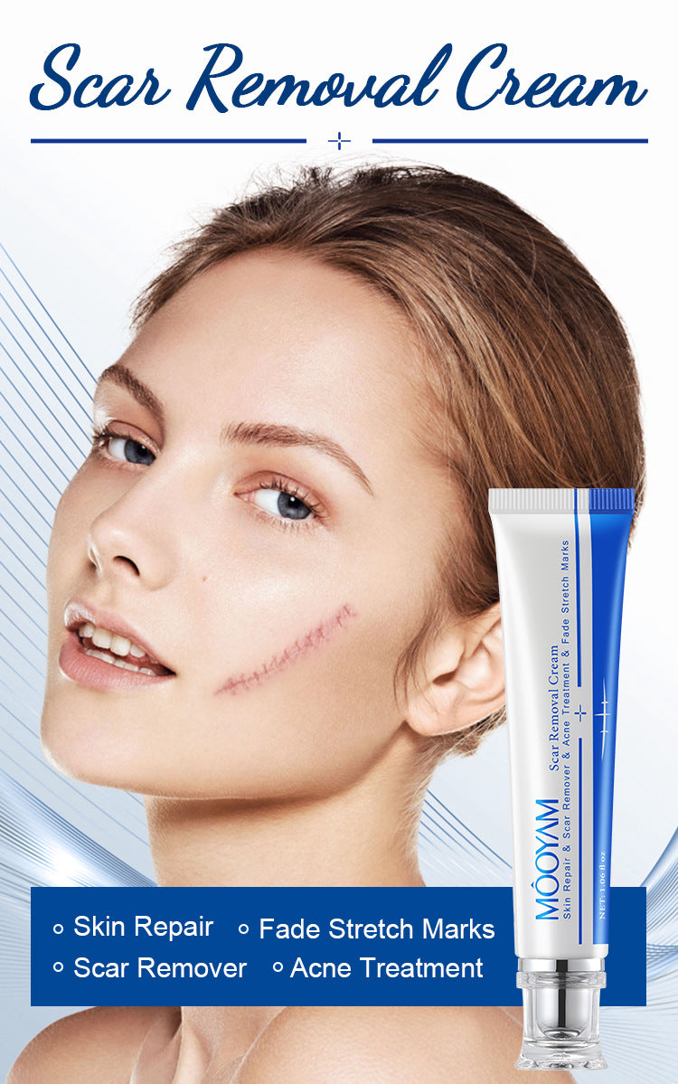 MOOYAM Scar Removal Cream tube and box, Skin Repair & Scar Remover & Acne Treatment & Fade Stretch Marks, 1.06 fl oz