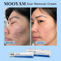MOOYAM Scar Removal Cream tube and box, Skin Repair & Scar Remover & Acne Treatment & Fade Stretch Marks, 1.06 fl oz