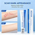 MOOYAM Scar Removal Cream tube and box, Skin Repair & Scar Remover & Acne Treatment & Fade Stretch Marks, 1.06 fl oz