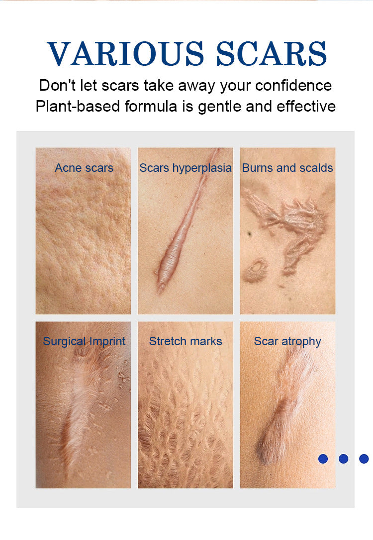 MOOYAM Scar Removal Cream tube and box, Skin Repair & Scar Remover & Acne Treatment & Fade Stretch Marks, 1.06 fl oz