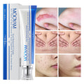 MOOYAM Scar Removal Cream tube and box, Skin Repair & Scar Remover & Acne Treatment & Fade Stretch Marks, 1.06 fl oz