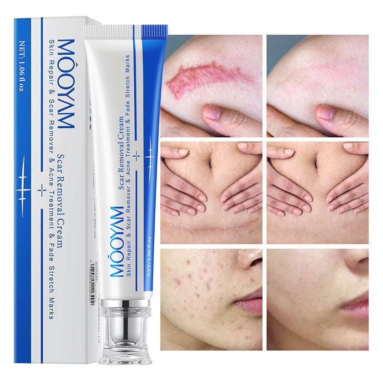 MOOYAM Scar Removal Cream tube and box, Skin Repair & Scar Remover & Acne Treatment & Fade Stretch Marks, 1.06 fl oz