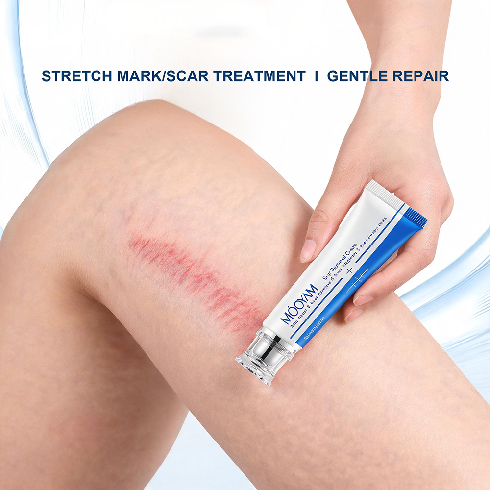 MOOYAM Scar Removal Cream tube and box, Skin Repair & Scar Remover & Acne Treatment & Fade Stretch Marks, 1.06 fl oz