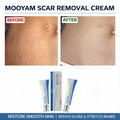 MOOYAM Scar Removal Cream tube and box, Skin Repair & Scar Remover & Acne Treatment & Fade Stretch Marks, 1.06 fl oz