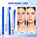 MOOYAM Scar Removal Cream tube and box, Skin Repair & Scar Remover & Acne Treatment & Fade Stretch Marks, 1.06 fl oz