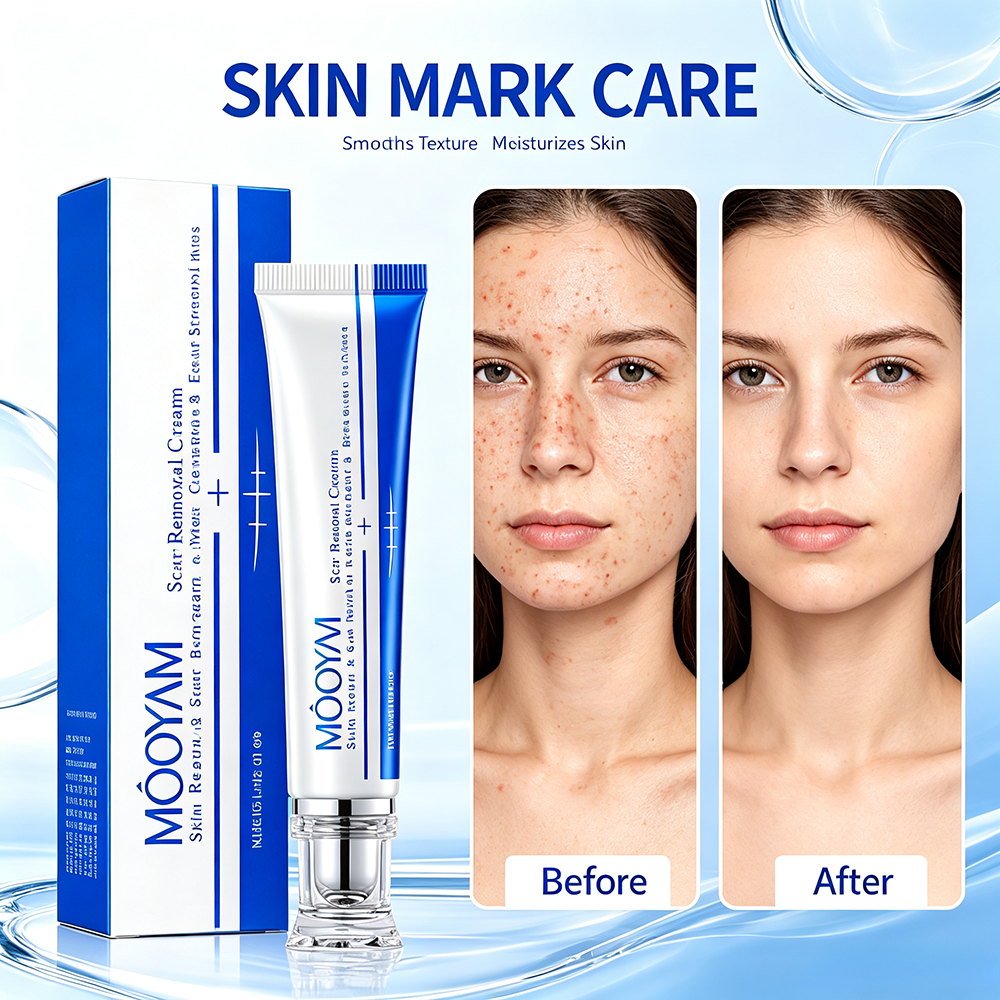 MOOYAM Scar Removal Cream tube and box, Skin Repair & Scar Remover & Acne Treatment & Fade Stretch Marks, 1.06 fl oz