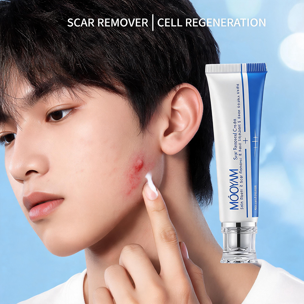 MOOYAM Scar Removal Cream tube and box, Skin Repair & Scar Remover & Acne Treatment & Fade Stretch Marks, 1.06 fl oz