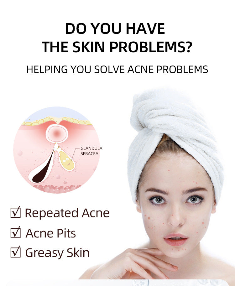 Salicylic Acid Acne Cream Treatment For Pimples Blackheads Herbal Extract Fast Repairing Skin Care