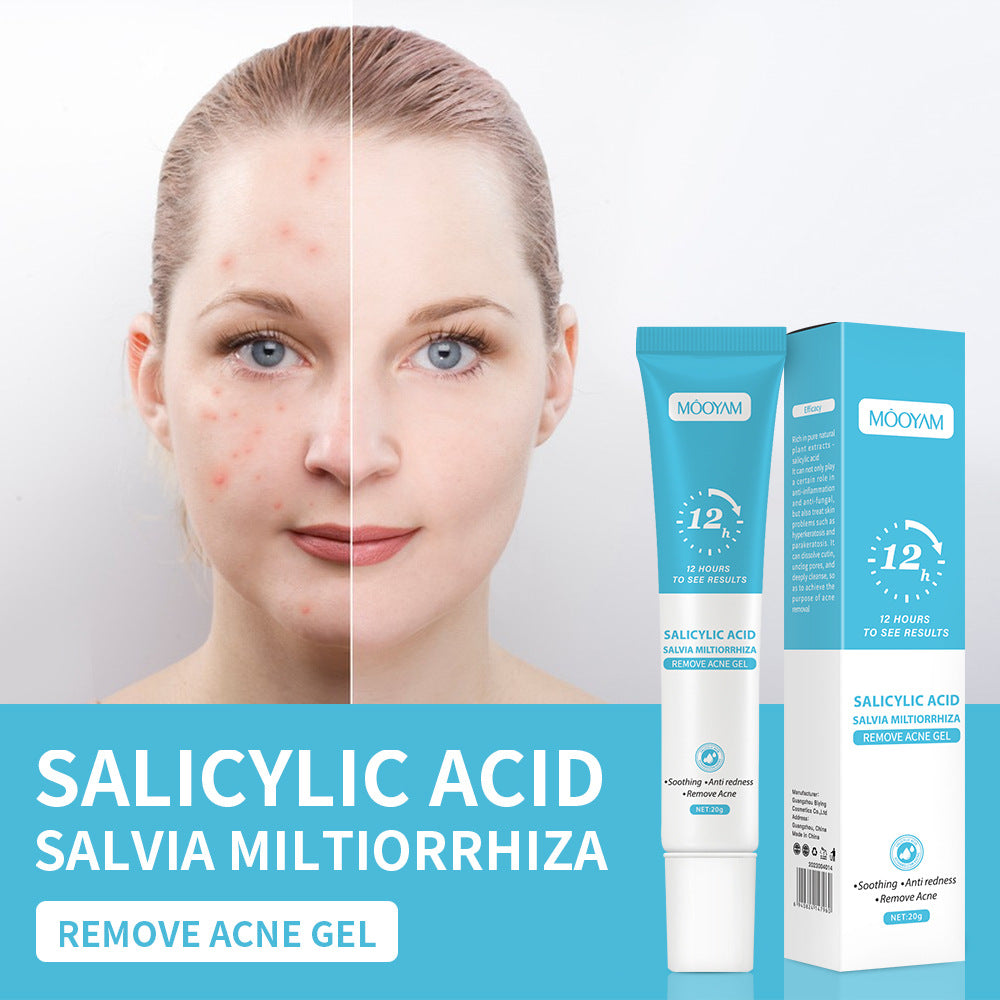 Salicylic Acid Acne Cream Treatment For Pimples Blackheads Herbal Extract Fast Repairing Skin Care