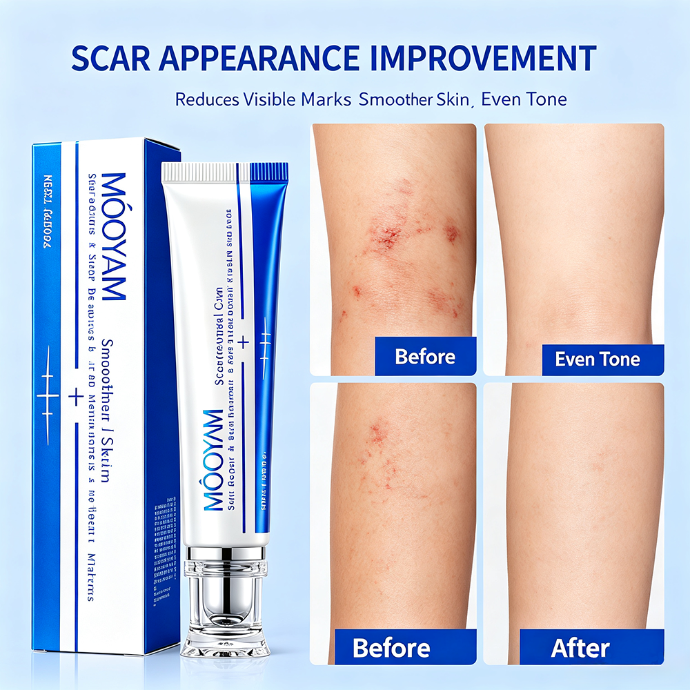 Daily Use Scar Renewal Cream Regenerative Moisture Balm for Dark Spots Marks